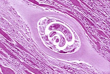 Campylobacter