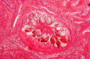 Campylobacter Echinococcus
